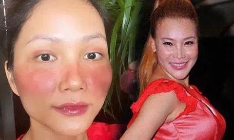 Phụ nữ Việt chớ dùng "kem trộn" vì cái mác rẻ đẹp như mỹ nhân Vbiz, kẻo tiền mất tật mang