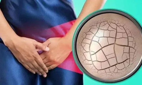 Làm sao cứu "cô bé" khô hạn mà không cần dùng thuốc? Bác sĩ tiết lộ 7 cách người phụ nữ nào cũng làm được