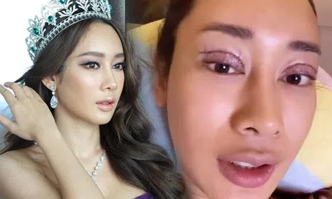 Hoa hậu Thái Lan "đập mặt xây lại" phải trả giá đắt, nhìn ảnh hậu thẩm mỹ chị em muốn dao kéo vội "quay xe"