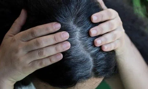 Còn trẻ mà đã thấy tóc bạc mọc ở 3 vị trí này, cẩn thận cơ quan nội tạng đang có vấn đề