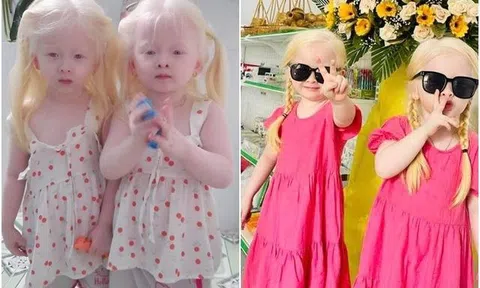 Hai bé gái song sinh bạch tạng ở Sóc Trăng giờ giúp bố mẹ đổi đời: Mỗi tháng làm video kiếm vài chục triệu, khai trương cháy hàng
