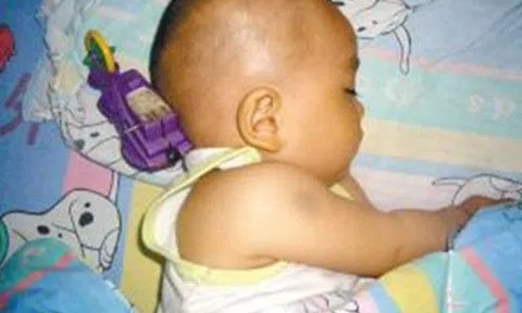 Con 11 tháng bị đồ chơi cắm vào não, hành động của người mẹ được bác sĩ tấm tắc khen