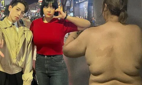 "Người yêu 138kg của Đức Phúc" giảm hơn 50kg và nâng ngực, giờ là mỹ nhân, chuyên trị đồ bó sát