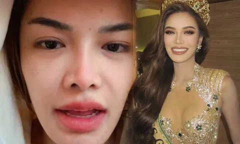 Mới đăng quang một ngày, Hoa hậu lộ mặt mộc "gây sốc", cằm lệch một bên khác xa ảnh đăng tải