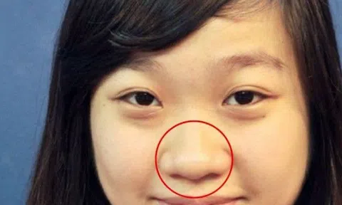 Phụ nữ chưa đến 40 tuổi mà xuất hiện 5 dấu hiệu này, có thể cơ thể đã bắt đầu lão hóa sớm