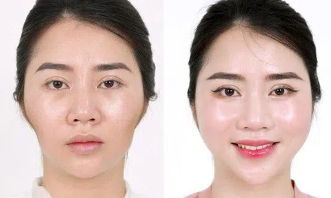 Sở hữu khuôn mặt đẹp đúng tỉ lệ vàng với công nghệ Gen tế bào AI Face JP