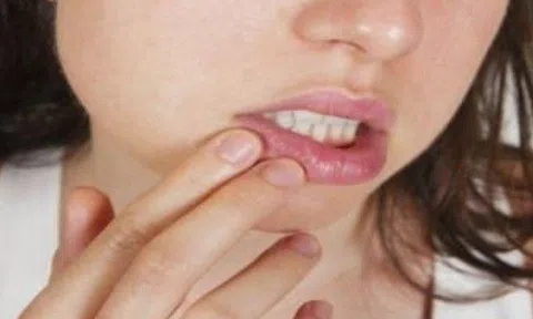 Chưa đầy 30 tuổi mà 2 tháng chỉ "yêu" một lần, vợ nghi chồng ngoài luồng khi trong miệng bỗng mọc lên thứ này