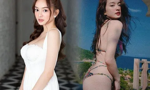 "Nấm lùn trăm tỷ" gọt mỡ để vòng 1 bớt phồn thực, sau 5 năm tung ảnh vẫn “nóng bỏng tay”