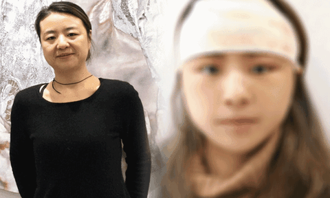"Cắt da mặt" được 1 tháng, người phụ nữ 48 tuổi "cải lão hoàn đồng", biến thành người khác