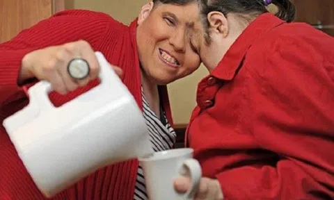 Cặp anh em song sinh dính liền tiết lộ chuyện tình dục như người thường, chỉ có 1 điều khác biệt