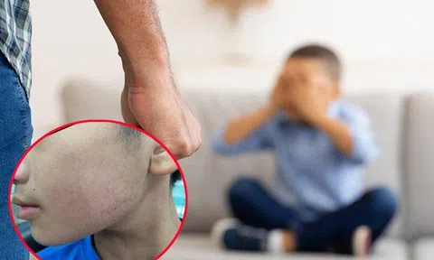 Con trai ăn nói dài dòng, bố là bác sĩ liền tác động vật lý 50 phát để dạy dỗ còn "khoe" trên MXH