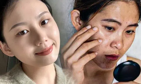Không phải tại tuổi tác, có 10 thói quen khiến chị em chưa qua 40 mà da dẻ đầy nếp nhăn, thua xa bạn bè