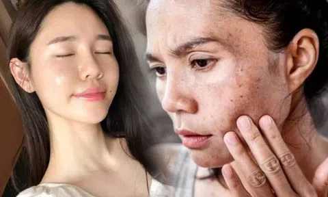 Không phải chống nắng, các chuyên gia cho biết hầu hết người có làn da nhẵn thín đều chung thói quen này