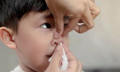 Bé trai 3 tuổi nguy kịch tính mạng vì bà nội xử lý theo cách dân gian khi cháu bị chảy máu cam