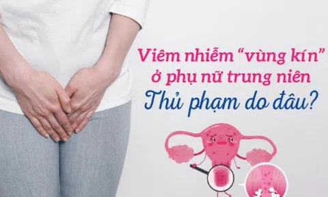 Viêm nhiễm “vùng kín” ở phụ nữ trung niên: Thủ phạm do đâu?