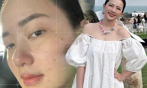 Phan Như Thảo dành cả thanh xuân để giảm cân, nay khoe ảnh mặt mộc bị bắt lỗi, không đẹp như mơ