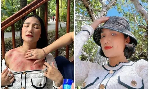 Sao Việt 24h: Cát Tường gây choáng khi "phanh áo" đánh gió giữa thanh thiên bạch nhật khiến khách Tây hoảng sợ
