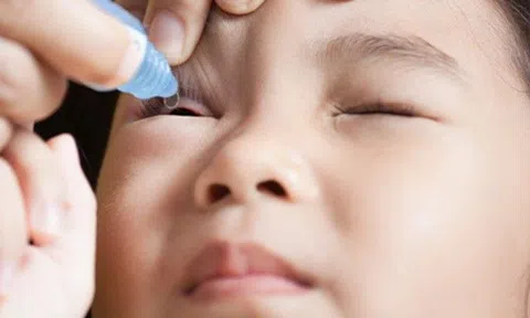 Dễ mù vĩnh viễn khi tự chữa đau mắt đỏ, bác sĩ hướng dẫn việc cần làm hàng ngày để bệnh nhanh khỏi