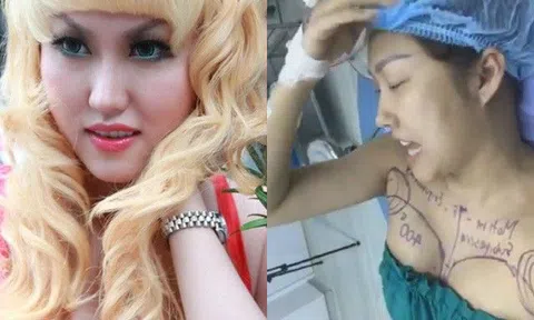 Nhan sắc từng bị chê "biến dạng" sau 21 lần dao kéo của Phi Thanh Vân giờ ra sao qua camera thường?