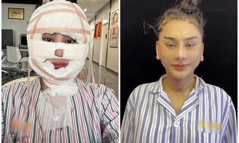 Sao Việt 24h: Lâm Khánh Chi băng kín mặt, tiết lộ hành trình đau đớn để đẹp hơn khiến dân mạng xót xa