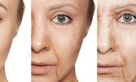 Nguyên nhân số một gây lão hóa nhanh, nhiều phụ nữ vô tình mắc nên dù chăm tập luyện, tẩm bổ vẫn mau già