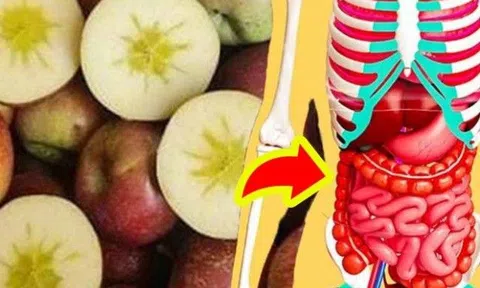 Điều gì sẽ xảy ra với cơ thể nếu bạn ăn một quả táo mỗi ngày?