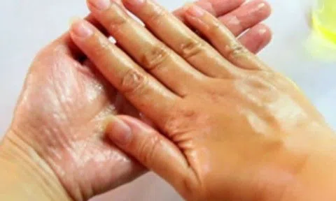 Người đàn ông không cầm được đũa ăn cơm vì học trên mạng dùng nhựa cây chữa bệnh
