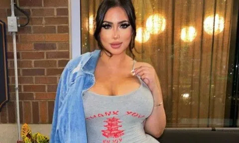 Nịt bụng từ năm 14 tuổi và "nghiện" thẩm mỹ, người phụ nữ có body "cháy" hơn búp bê Barbie