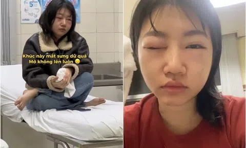 Hé lộ lý do Á quân Ca Sĩ Mặt Nạ sưng vù mắt mũi không nhận ra, nhìn mà thương