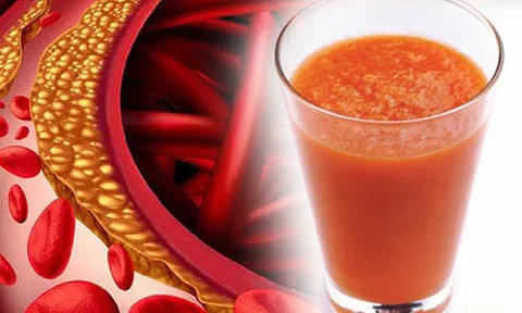 Bác sĩ chỉ cách làm cốc nước ép "quét sạch" bẩn trong mạch máu, giúp nhiều người tránh căn bệnh chết nhanh hơn ung thư