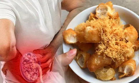 Bác sĩ thận chỉ ra 7 thực phẩm gây nát thận nhanh nhất, có 2 món nhiều gia đình ăn mỗi sáng