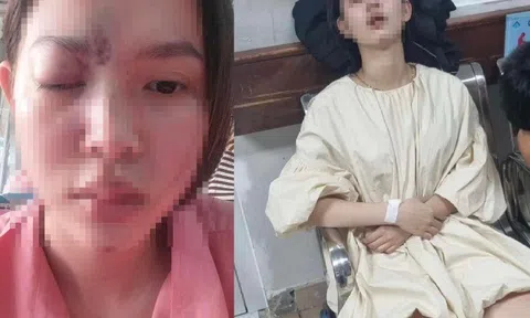 Cô gái trẻ ở Đồng Nai mù mắt khi đi làm đẹp, bác sĩ cảnh báo nhiều biến chứng còn đáng sợ hơn nhiều