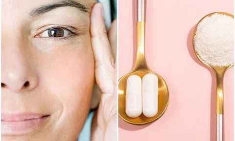 Uống collagen có lợi gì? Cảnh báo những người không nên uống collagen kẻo lợi ít hại nhiều