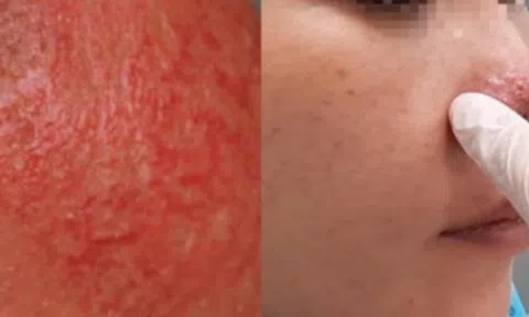 Tức mình vì câu nói "vợ già hơn chồng", người phụ nữ làm ngay một việc để đón Tết khiến mặt đỏ như tôm luộc