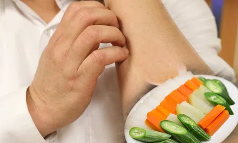 Sau một tuần ăn thịt ba chỉ, làn da người đàn ông biến đổi ngoạn mục, bác sĩ chỉ rõ lý do ít ai biết