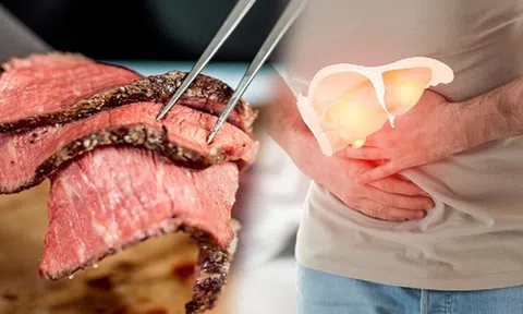 Gan nhiễm mỡ không nên ăn gì? Những thực phẩm càng ăn càng khiến gan nhanh "xơ như mướp"