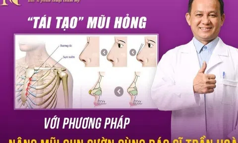 “Tái tạo” mũi hỏng với phương pháp nâng mũi sụn sườn cùng bác sĩ Trần Hoàng