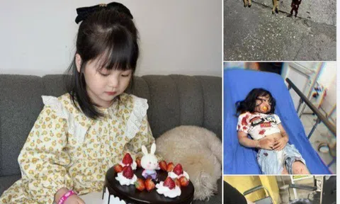 Bé gái đáng yêu bị chó chưa tiêm phòng dại cắn gây phẫn nộ cộng đồng mạng hiện giờ sức khỏe ra sao?