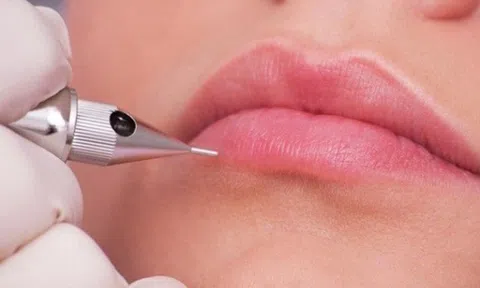 Sau 3 ngày xăm môi, cô gái có dấu hiệu lạ nghi sùi mào gà, hóa ra mắc loại bệnh không thể chữa khỏi