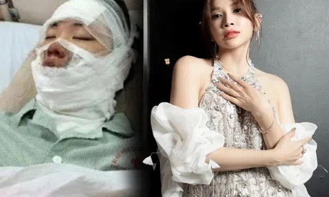 Mỹ nhân Việt từng bị lửa táp vào mặt, bỏng cấp độ 2 giờ "giàu ngầm" nhưng lẻ loi ở tuổi 37