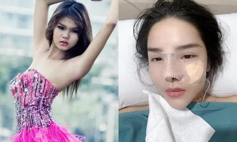 Vợ Mạc Hồng Quân hé lộ diện mạo giai đoạn "thẩm mỹ hỏng", giờ phải chi 90 triệu sửa mũi lần 4
