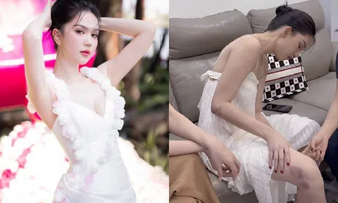 Ngọc Trinh chi hơn 40 triệu, quằn quại đau đớn để cứu vãn vết sẹo do "làm xiếc" trên xe mô tô