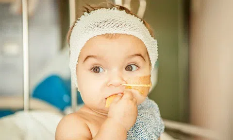Căn bệnh khiến trẻ có gương mặt xinh như búp bê, được BHYT chi trả tới hơn 3 tỷ đồng
