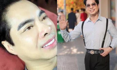 Ca sĩ Ngọc Sơn "nối gót" đạo diễn Lê Hoàng, MC Thanh Bạch làm thẩm mỹ: U60 xăm môi hồng tươi