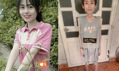 Cô gái Hưng Yên nặng 18kg sau nhiều năm bỏ ăn cơm để giảm cân, bác sĩ cảnh báo: Đừng khuyên nhau cắt tinh bột!