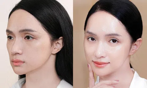 Công nghệ trẻ hoá da được hoa hậu Hương Giang lựa chọn
