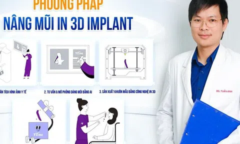 Bác sĩ Nguyễn Tuấn Anh ứng dụng thành công công nghệ nâng mũi In 3D Implant