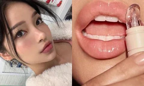 Tiêm filler môi tưởng đơn giản nhưng làm sai rất khó sửa, chị em lưu ý trước khi làm đẹp đón Tết 2025
