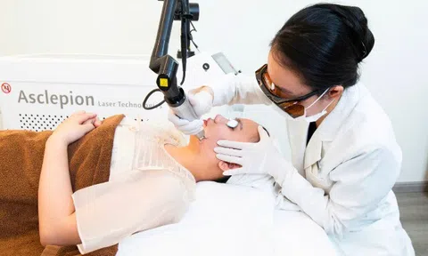 Đột phá trong điều trị nám: Laser công nghệ cao được ưa chuộng hiện nay