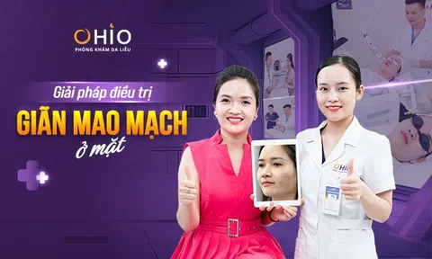 Cách chữa giãn mao mạch ở mặt an toàn và hiệu quả